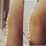لابیوپلاستی و زیبایی زنان در غرب تهران