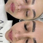 کلینیک زیبایی پانو