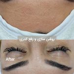 خدمات تخصصی فیشال