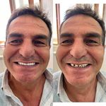 دندانسازی محلات (فتح المبین )