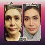 مطب پوست ،مو و لیزر یسنا طب