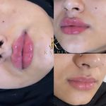 کلینیک زیبایی کاترین