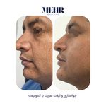 کلینیک زیبایی مهر