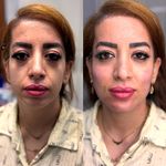 مرکز تخصصی لیزر موهای زائد پریناز شرق