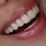 دندانسازی صدف(عسگری)