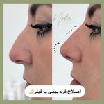 کلینیک زیبایی و لیزر مو زائد نوبا