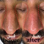 سالن تخصصی کوتاهی مو و فیشیال امیربارویی