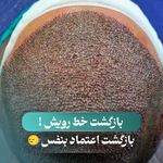 کاشت مو ابان