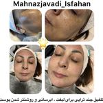 خدمات تخصصی  پوست و مو  مهناز جوادی