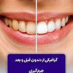 کلینیک دندانپزشکی صدرا  تهران