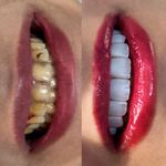 دندانپزشکی دکتر فائزه علی نژاد رودسری