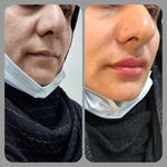 کلینیک لیزر و زیبایی مهرُنا