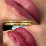 میکروکیماسی( میکروابرو چشم لب،ریمو)