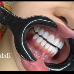 مطب دندانپزشکی دکتر فاطمه عبدی