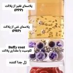 مرکز PRP آجودانیه