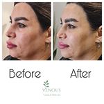 خدمات پوست ونوس