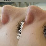 پاکسازی صورت فیشال تخصصی بانو