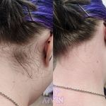 مرکز لیزر و کلینیک زیبایی آروین