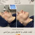مرکز لیزر ،پوست و زیبایی کندی بیوتی