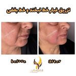 کلینیک زیبایی و مرکز لیزر هانیسا