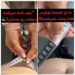 کلینیک زیبایی و لیزر لوتوس