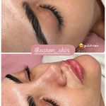 کلینیک فیشال و ماساژ سارن اسکین سارا