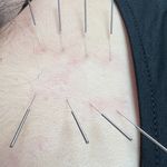 کلینیک فیزیوتراپی یاشیل