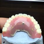 ساخت تخصصی دندان مصنوعی (ایران دنت)