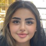 ژل و بوتاکس مونالیزا
