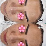 مرکز تخصصی فیشال و پاکسازی پوست تینا