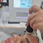 لیزر فیشیال پلاژن تراپی سمیرا