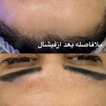 مرکز تخصصی فیشال و پاکسازی پوست حنانه