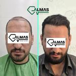 کلینیک پوست،زیبایی ولیزر وکاشت مو الماس