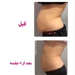 کلینیک تغذیه و رژیم درمانی و تناسب اندام (دکتر هانیه روانبخش)