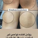 کلینیک لیزر و زیبایی مهسان