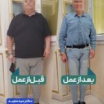 دکتر سادات منصوری جراح متخصص چاقی