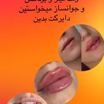 کلینیک لیزر و زیبایی مهسان