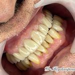 مطب دندانپزشکی تخصصی دکتر زینب حیدری پور