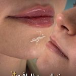 مطب پوست زيبايی ليزر دکتر شاه نعمت الهی