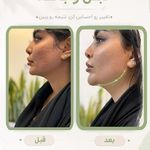 مرکز لاغری آنجل فیت