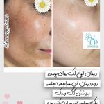 کلینیک پوست و مو و لیزر نیلوفر آبی