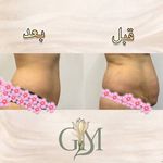 مرکز تخصصی لاغری گل مریم
