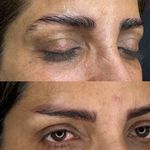 میکروکیماسی( میکروابرو چشم لب،ریمو)