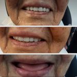 دکترای پروتزهای دندانی اکبری