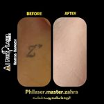 مرکز تخصصی لیزر تتو زهرا کفعمی