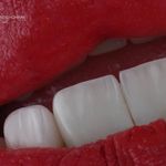 دندانپزشکی زیبایی دکتر پریسا دهقانی