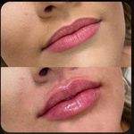 کلینیک پوست،مو،زیبایی،مرکز لیزر ‌پرنسا