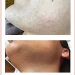 مرکز تخصصی لیزر الکساندرایت کندلا آرشیدا