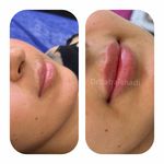 کلینیک تخصصی ژل و بوتاکس مرضیه آقابابایی