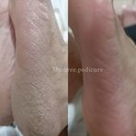 پدیکورتخصصی شهره